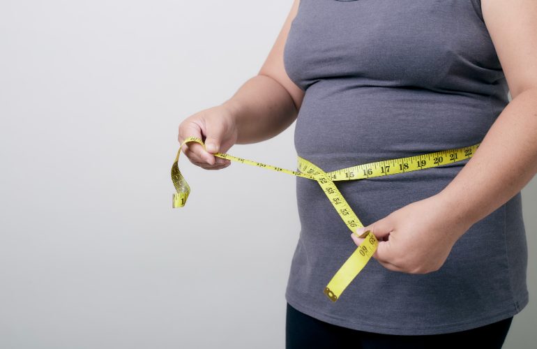 La obesidad es una enfermedad compleja que consiste en tener una cantidad excesiva de grasa corporal. La obesidad no es solo un problema estético.