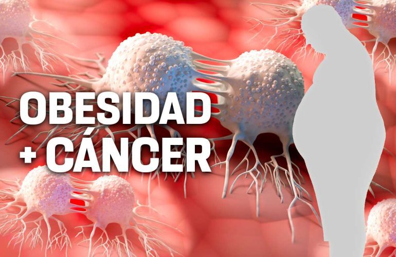 Los especialistas médicos han encontrado evidencia de que la obesidad puede aumentar el riesgo de sufrir de 13 tipos de cáncer, incluyendo adenocarcinoma de esófago, cáncer de mama (en mujeres que hayan pasado por la menopausia)