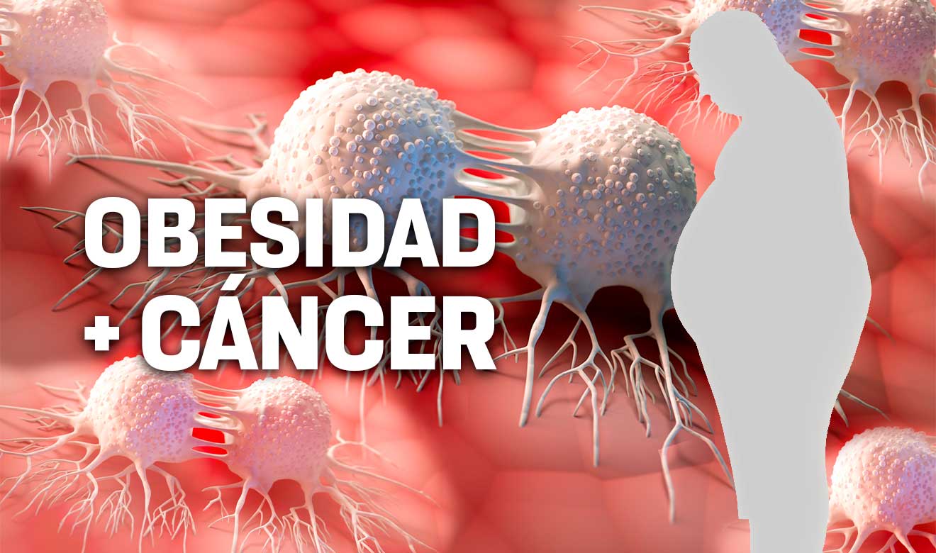 Los especialistas médicos han encontrado evidencia de que la obesidad puede aumentar el riesgo de sufrir de 13 tipos de cáncer, incluyendo adenocarcinoma de esófago, cáncer de mama (en mujeres que hayan pasado por la menopausia)